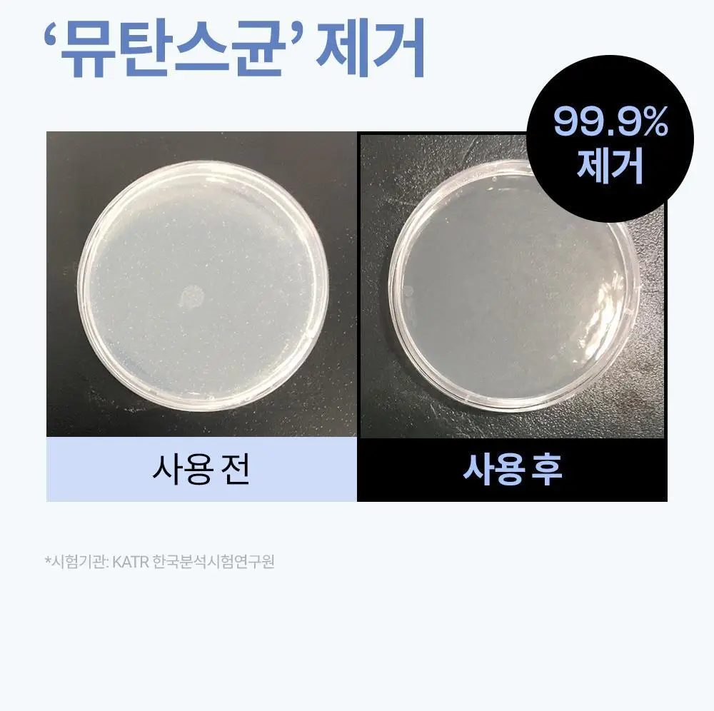 [진지발리스균 99.9%제거] 언파 차차 에너지 잇몸 치약 (100g) 상세페이지 11